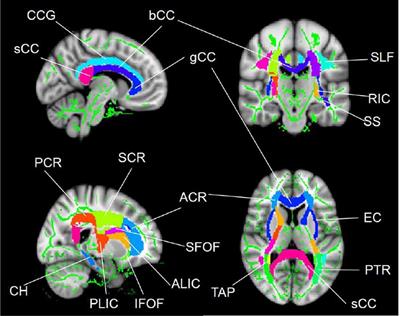White Matter Microstructure Alterations in Patients With Spinal Cord Injury Assessed by Diffusion Tensor Imaging